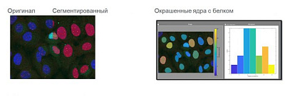 Автоматический подсчет FISH – сигналов в ядрах клеток